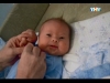 ребенок с синдромом дауна